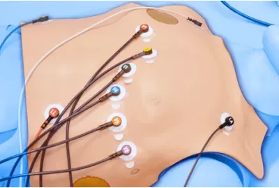 HAL&reg; 12-Lead ECG Upgrade