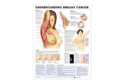 Understanding Breast Cancer