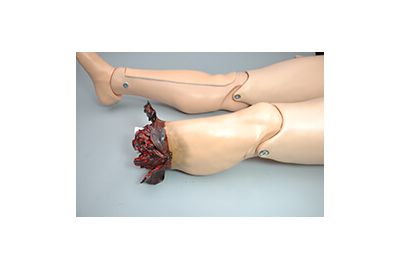 Traumatic Leg Amputation for HAL S3201 (S3201.004)