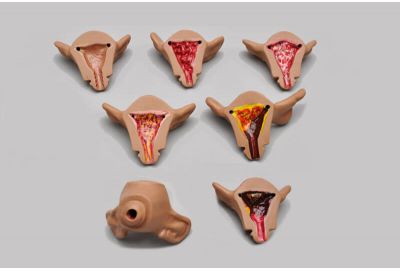 Normal and Abnormal Uteri with Internal Pathologies