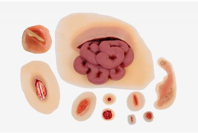 ACLS Trauma Wound Kit - WK180