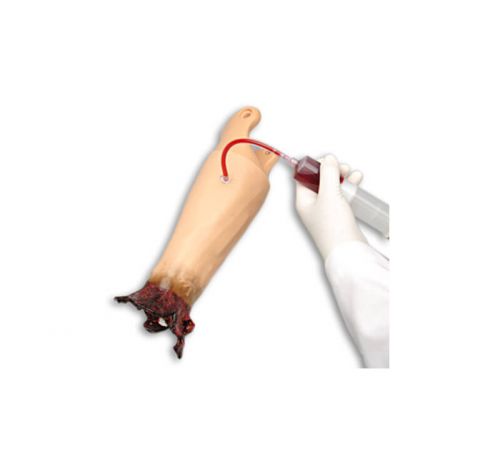 Traumatic Arm Amputation for HAL S3201 (S3201.005)