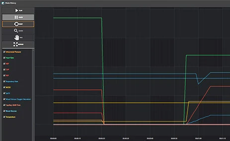 histogram