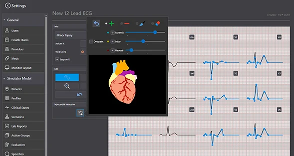 s3201-ecg