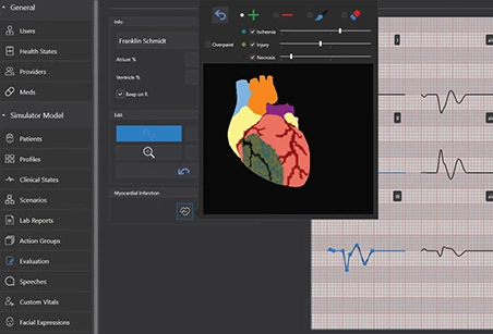 s5301-uni-myocardial infarction designer