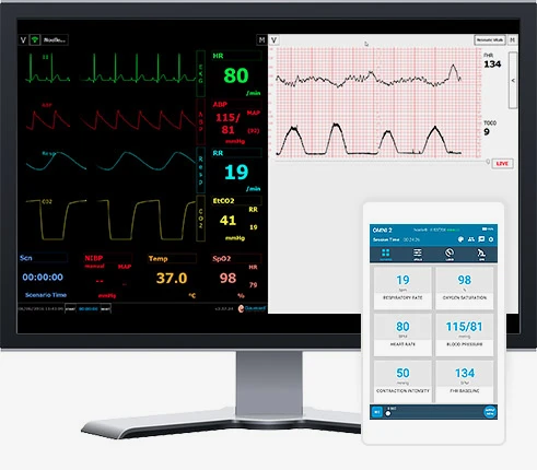 omni2-ob-monitor